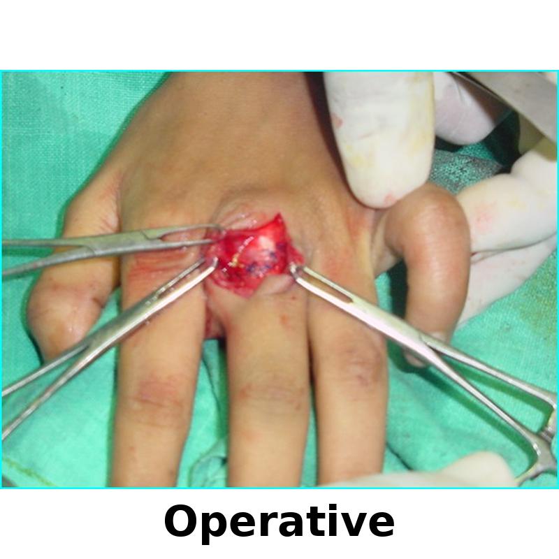 Case 1 Operation Image