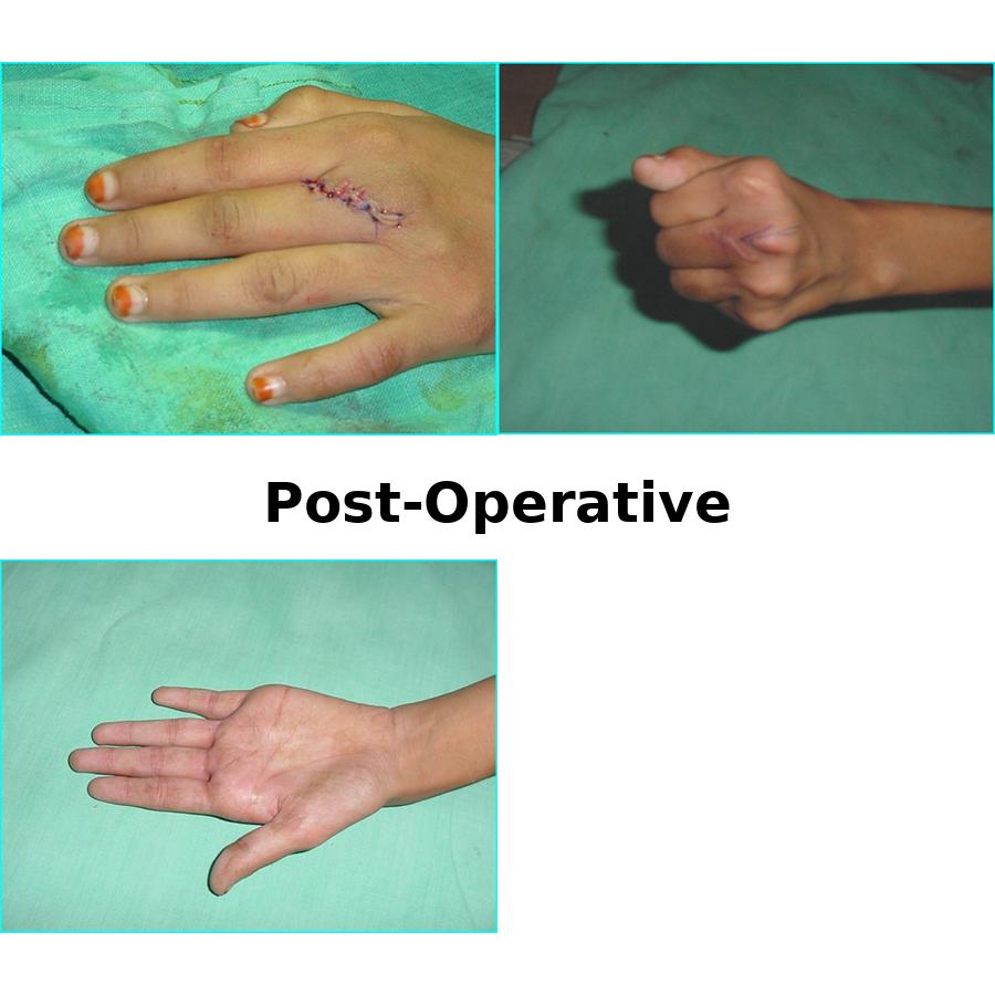 Case 1 After Image