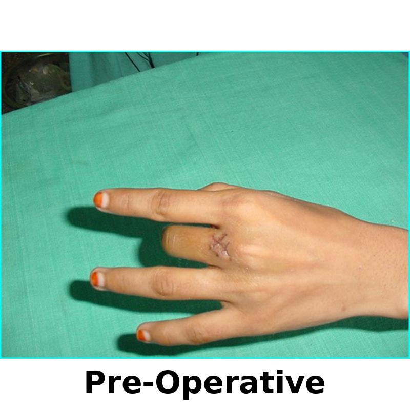Case 2 Before Image