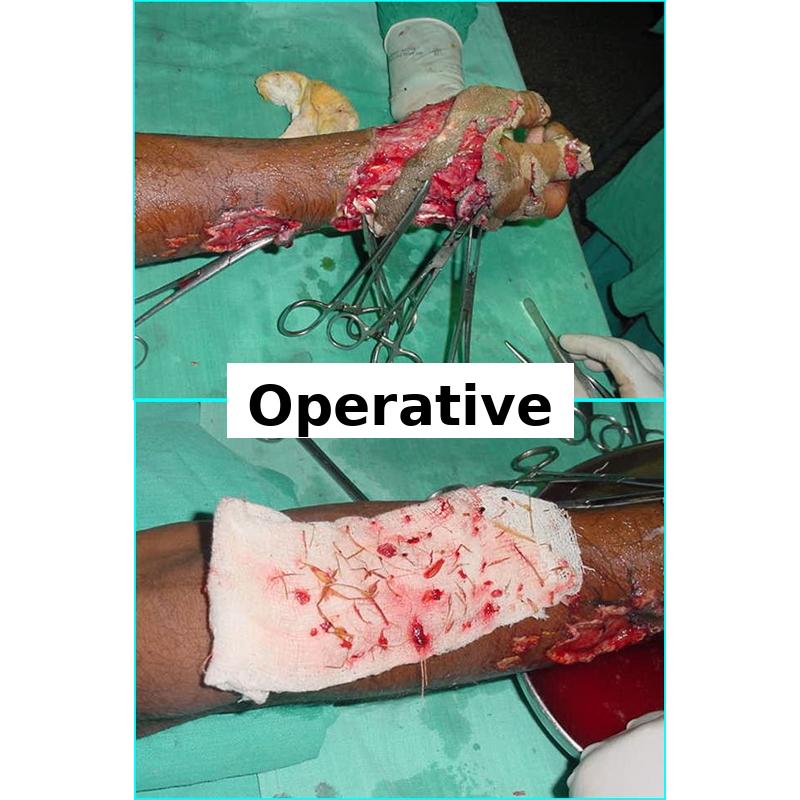 Case 1 Operation Image