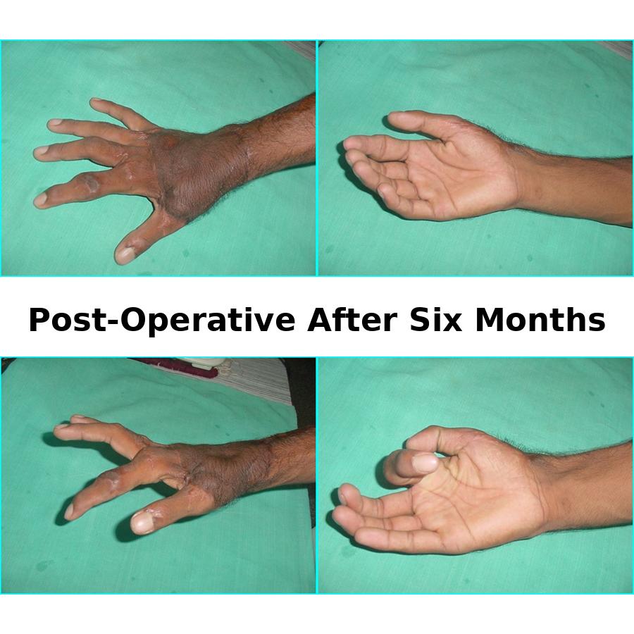 Case 1 After Image