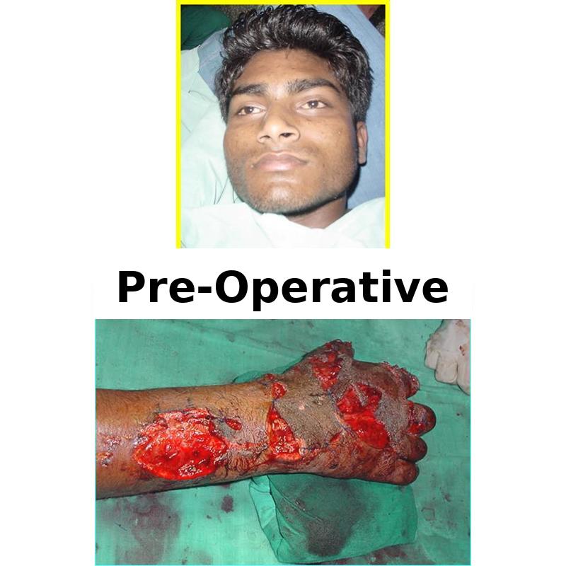Case 2 Before Image