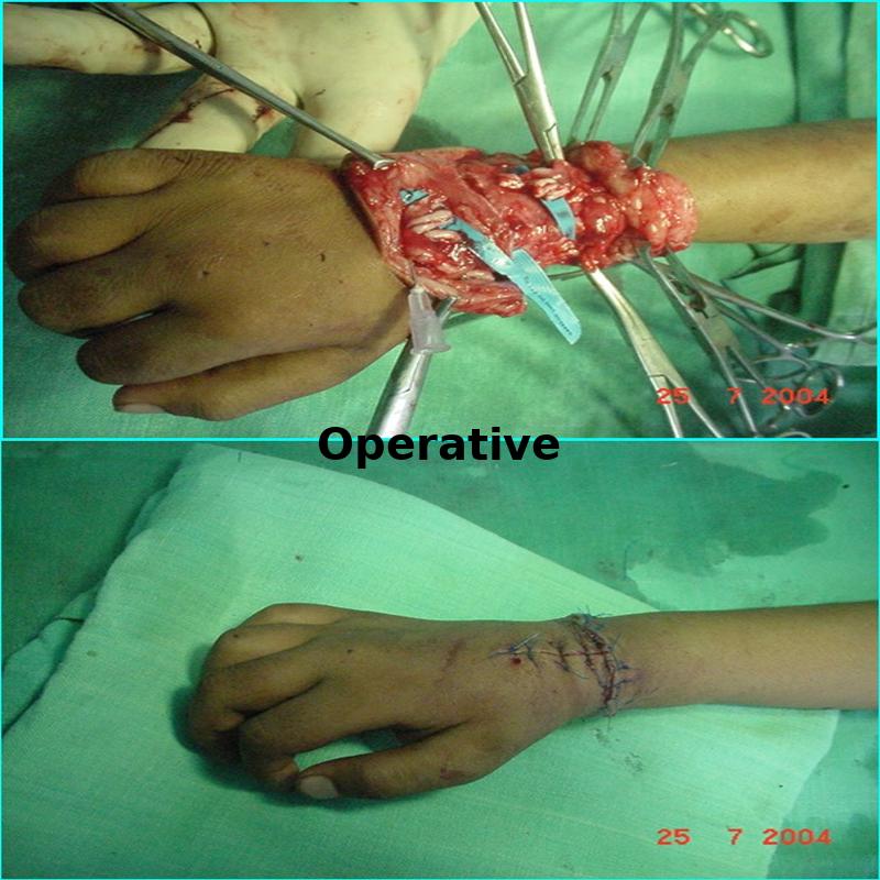 Case 1 Operation Image