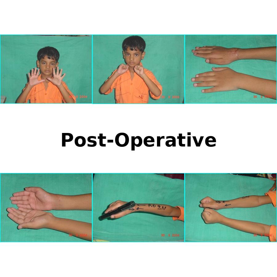 Case 1 After Image