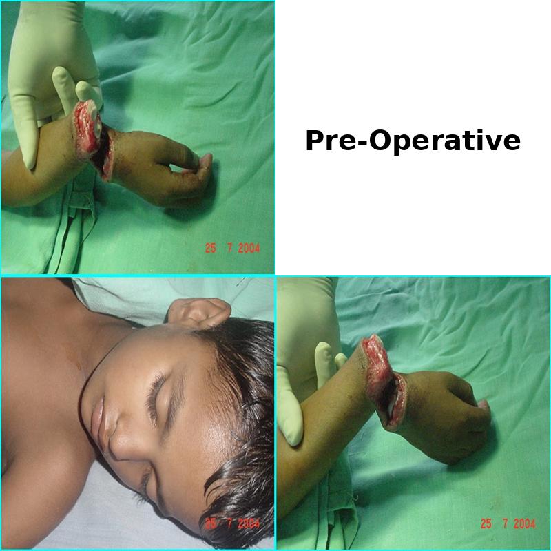 Case 2 Before Image